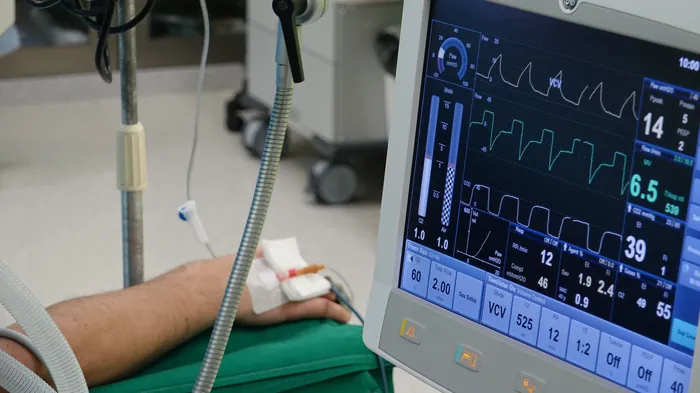 Intensive care monitoring equipment